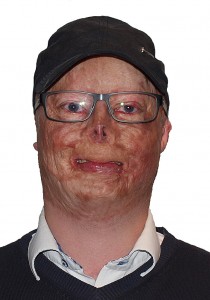 Lars.2